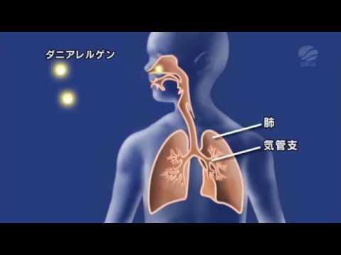 小児ぜん息の原因を探れ！　（ダニ対策の実践2/6）