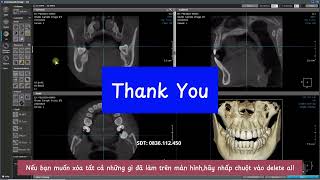 Hướng dẫn sử dụng phần mềm OneDemand 3D  - CBCT Rayscan
