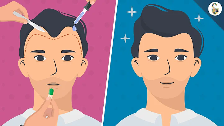 Hair Loss Treatments For Men (According To Science) - DayDayNews