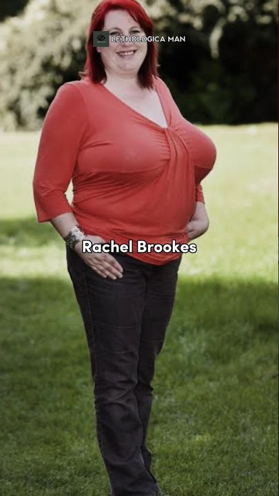 Hampir Meninggal Karena Dada Besar : Rachel Brookes #lethologicaman