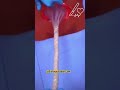 Cesarean delivery📮 #baby #ultrasound #ytshorts  #brith #delivery #babyborn