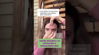 Морщина на переносице