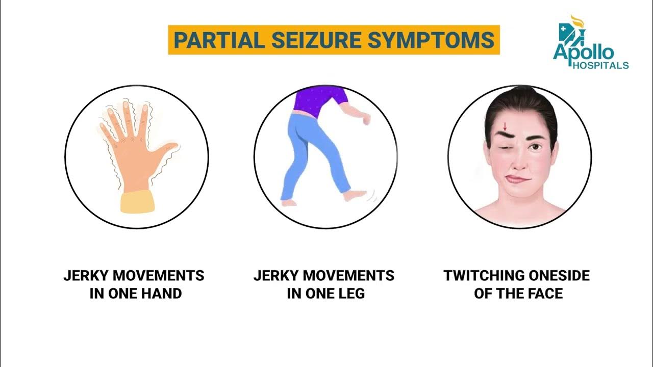 types-of-seizures-dr-sudhir-kumar