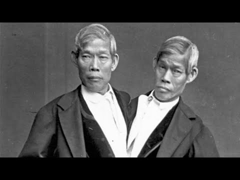 Video: Kembar Siam dan kisah mereka