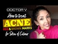 Doctor V - How To Treat Acne Red & Brown Marks for Skin of Colour | Brown/ Black skin