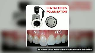 Camera Dental Photography - No Reflection Cross Polarization Set For Godox MF-R76 Flashes. Ring Flas