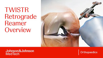 How to Use the TWISTR Retrograde Reamer System: Step-by-Step Guide | DePuy Synthes