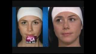 Lipofreeze Outdoes Rip Off Treatments