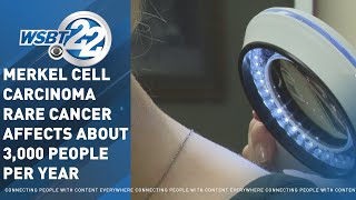 South Bend Dermatologist Discuss Jimmy Buffetts Rare Type Of Cancer