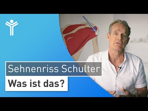 Sehnenriss an der Schulter: Warum Sie Ihre Schulterschmerzen rechtzeitig behandeln lassen sollten