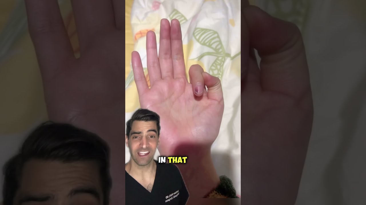 How to use imperial feet nail fungus mycosis treatment｜TikTok Search