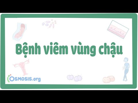 Video: 3 cách nhận biết bệnh viêm vùng chậu (PID)