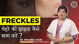 Freckles क्या होते हैं? (चेहरे की झाइयां कैसे खत्म करें) | Dr. Nivedita Dadu | Dadu medical Centre