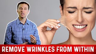 How To Get Rid Of Wrinkles? – Dr. Berg on Collagen Peptides