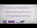 How to Self-Examine for Tender and Swollen Joints in Rheumatoid Arthritis