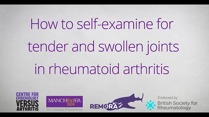 How to Self-Examine for Tender and Swollen Joints in Rheumatoid Arthritis