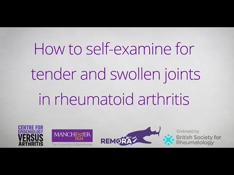 How to Self-Examine for Tender and Swollen Joints in Rheumatoid Arthritis