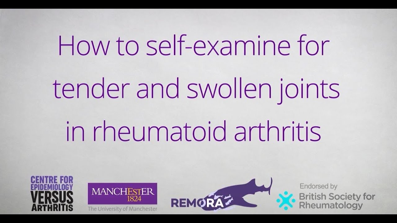 How to Self-Examine for Tender and Swollen Joints in Rheumatoid Arthritis -  YouTube