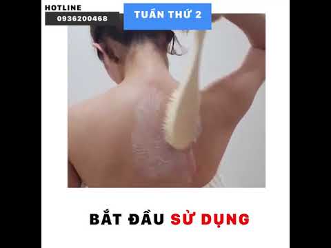 Xà Phòng Trị Mụn Lưng Acne Body Bar - Acne Body Bar - Xà phòng trị mụn lưng giá chỉ 170K, gọi 0932018020