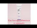 ZO Skin Health Acne Control или как за одну ночь избавиться от прыщей