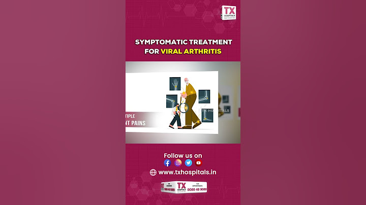 𝗧𝗿𝗲𝗮𝘁𝗺𝗲𝗻𝘁 𝗙𝗼𝗿 𝗩𝗶𝗿𝗮𝗹 𝗔𝗿𝘁𝗵𝗿𝗶𝘁𝗶𝘀 || 𝗗𝗿. 𝗞𝗿𝗶𝘀𝗵𝗻𝗮 𝗣𝗿𝗮𝗯𝗵𝗮𝗸𝗮𝗿 || 𝗧𝗫 𝗛𝗼𝘀𝗽𝗶𝘁𝗮𝗹𝘀