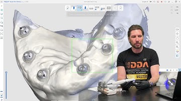 🚀 Scan Ladder x Medit SmartX: Full Workflow Tutorial! 🚀