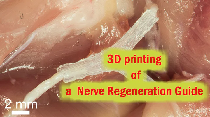3D-Printed Guide helps regrow complex Nerves after injury