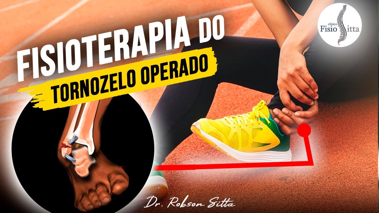 FRATURA DO TORNOZELO TRATAMENTO de FISIOTERAPIA e RESULTADOS IMEDIATOS Clínica Dr. Robson Sitta ®