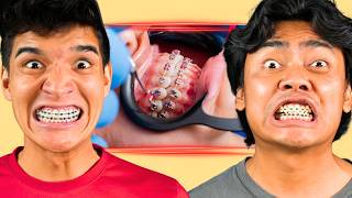 Alex and Roi Got Adult Braces?!