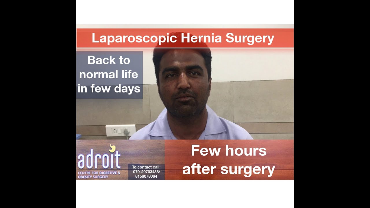 hernia surgery recovery લેપરોસકોપીક હર્નિયા સર્જરી: દર્દી નો અનુભવ Laparoscopic hernia surgery: patient review, Ahmedabad
