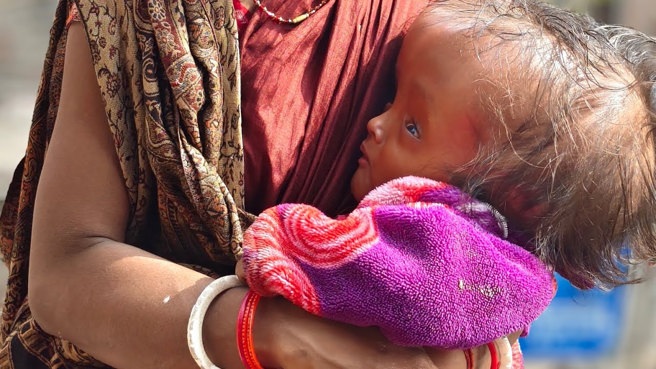 ❤️ krishna का तबीयत में सुधार है पहले से 🥹🥹 @babycare-tl5lp 