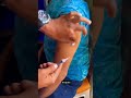 im injection 💉💉💊 #ytshorts #injection #organclinic #injectionvlogs