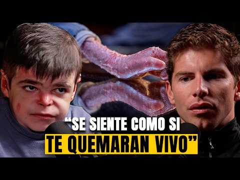 #246 - Así es la Vida de un Niño con Piel de Mariposa - Leo Gutiérrez