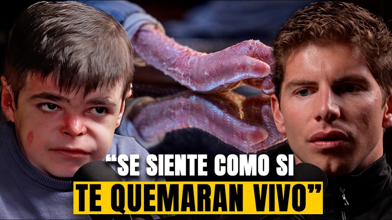#246 - Así es la Vida de un Niño con Piel de Mariposa - Leo Gutiérrez