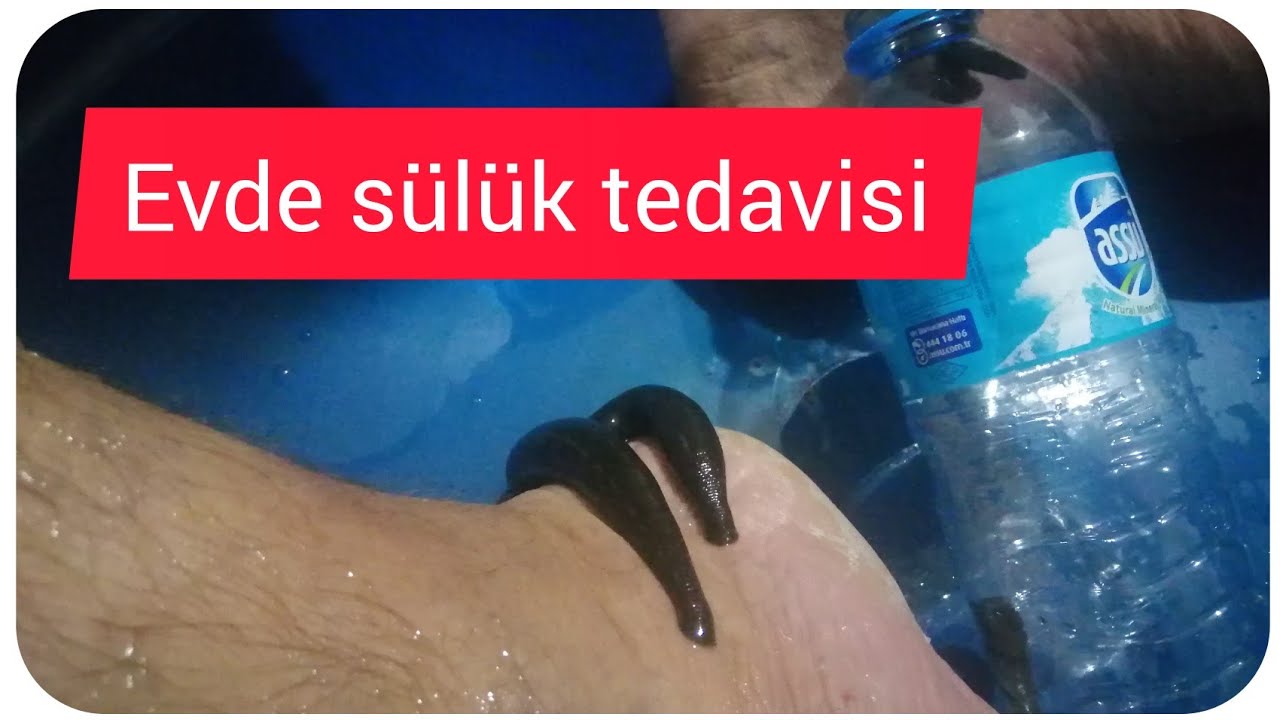 suluk tedavisi nasil yapilir evde suluk tedavisi aile boyu youtube