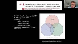 Management of tuberculous meningitis:An update- Dr.  Guy Thwaites