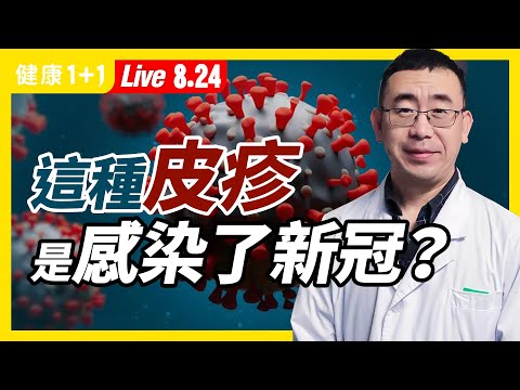 【直播】2021英国大型研究：约1/5新冠患者皮肤红疹是唯一症状！身体出现哪些皮肤问题，可能与新冠病毒有关？新冠红疹和普通皮肤病红疹要怎样区分？这种情况及早就医！（2021.8.24）