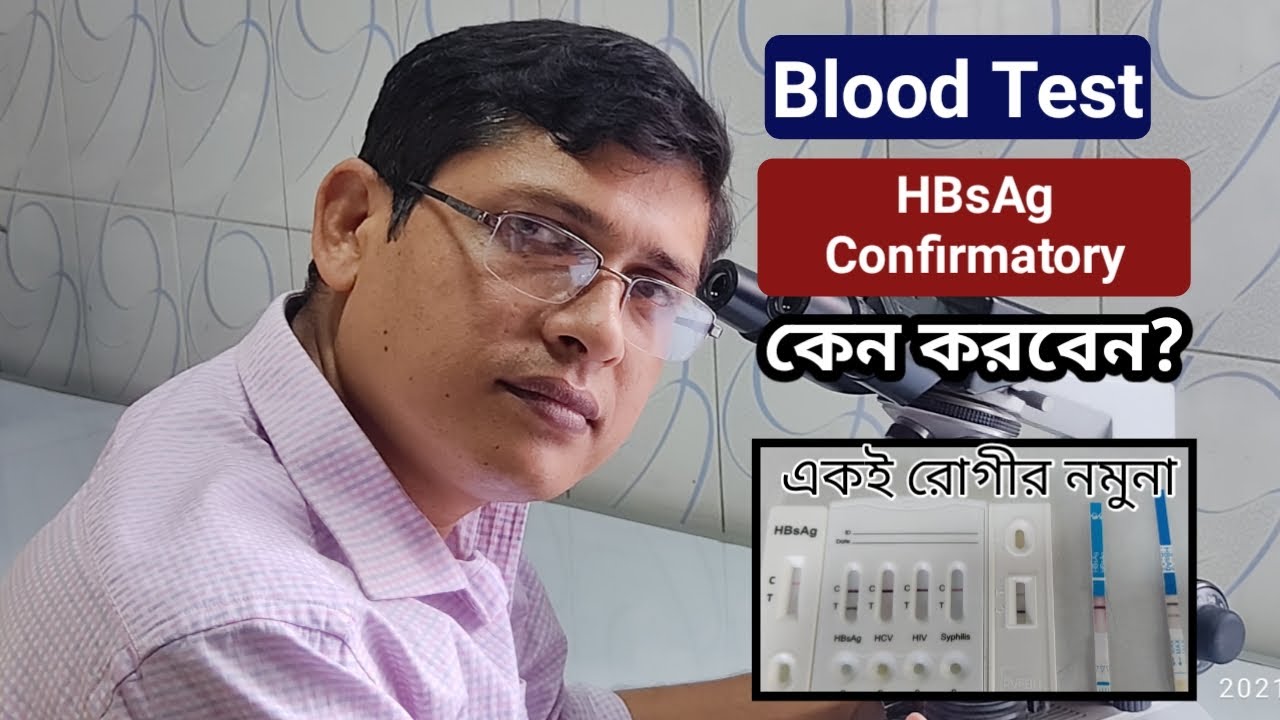 HBsAg Confirmatory Test YouTube