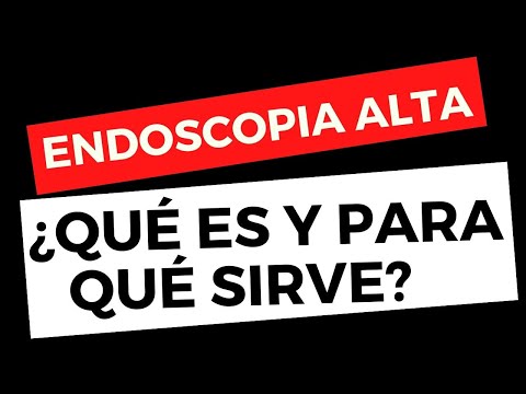 Qué es una