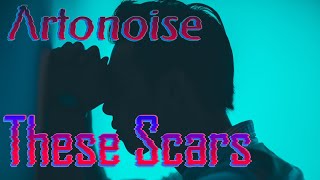 Λrtonoise - These Scars