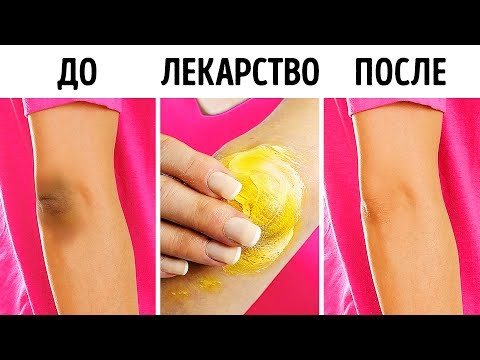 10 Эффективных Приемов, Чтобы Осветлить Колени и Локти