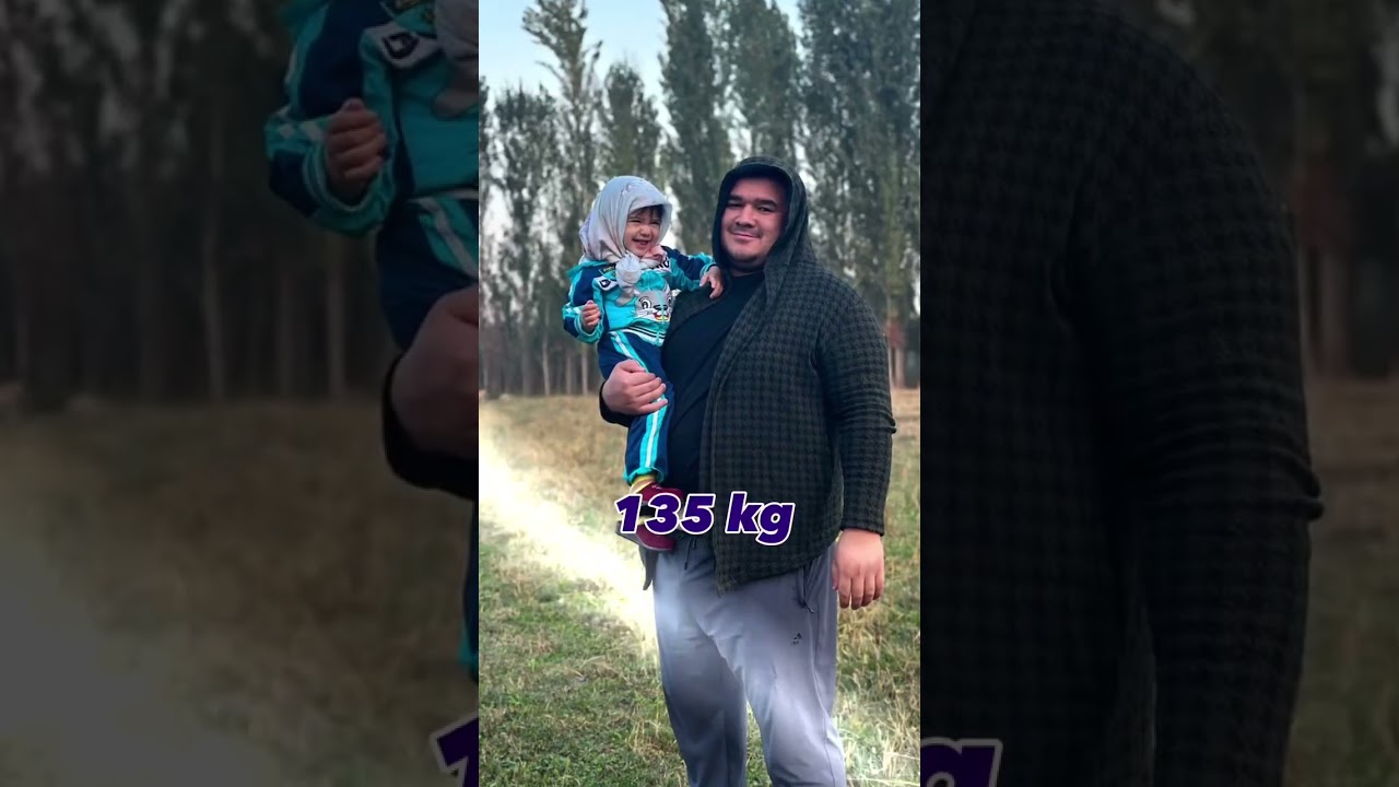 Bariatriya #surgery #tashkent #bariatric #bariatricsurgery #ozish...