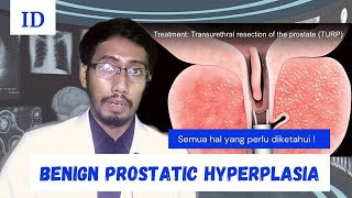 Sebab Sulit Kencing Pembesaran Prostat jinak, Kanker Prostat? #YouTubeHealth #YouTubeHealthIndonesia