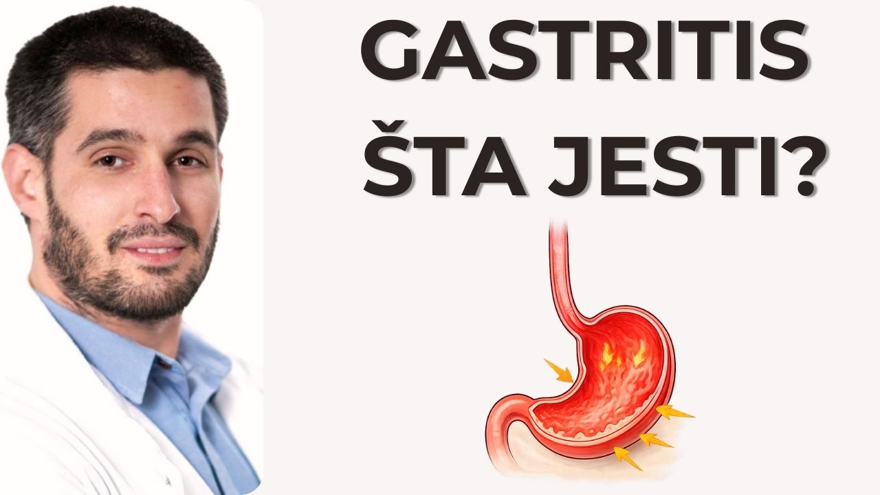 GASTRITIS: Šta je u redu a šta nije?