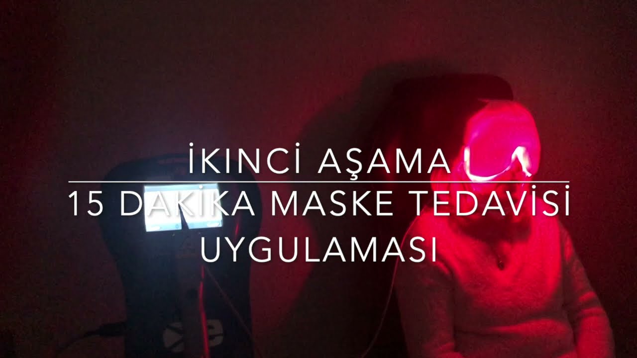 IPL Lazerle Göz Kuruluğu Tedavisi Uygulamalı Anlatım - Prof. Dr. Ahmet Akman