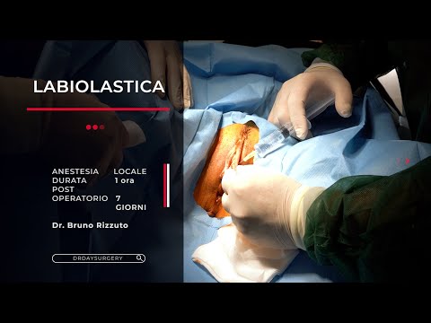 LABIOPLASTICA - Intervento di Chirurgia Estetica Intima