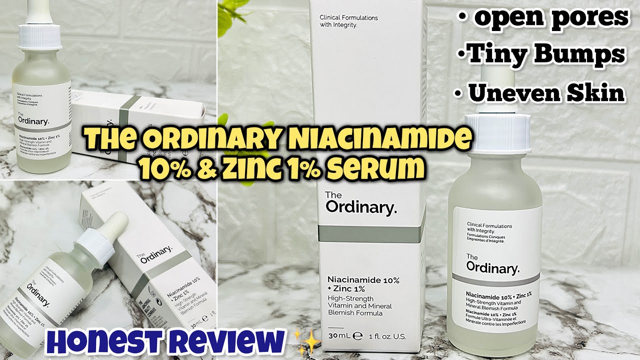 The Ordinary Niacinamide 10% + Zinc 1%: My Honest Review! || Best face serum for acne & dark spots