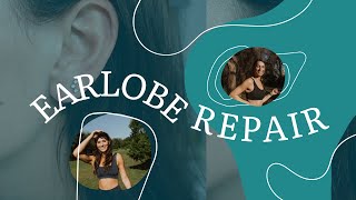 I Got Plastic Surgery! Earlobe Repair Before + After, What To Expect...