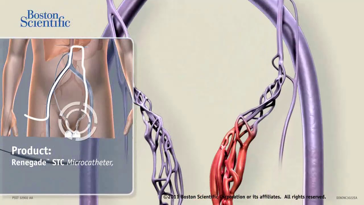 youtube-video-thumbnail