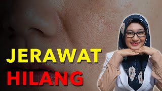 Seminggu Pakai Es Batu Ke Muka??